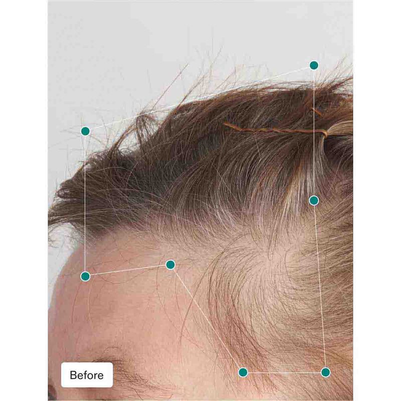 nutrafol balance hair growth nutraceutical 120 capsules