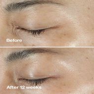 faces سيروم كلينيك سمارت كلينيكال ريبير رينكل كوريكتنغ