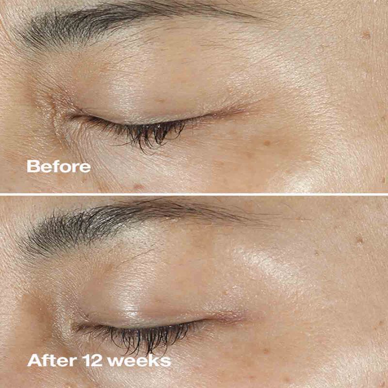 كلينيك سيروم كلينيك سمارت كلينيكال ريبير رينكل كوريكتنغ