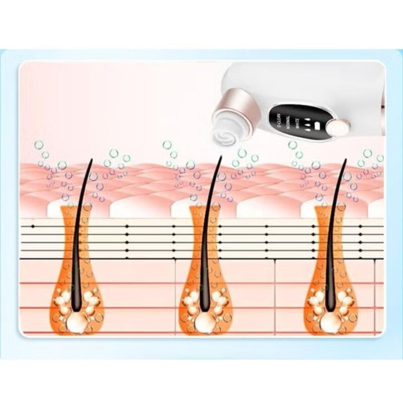 rhea beauty blackhead suction pore cleaner, 6 suction heads, 3 modes, usb charging facial cleansing, pick vacuum cleaner, device blackhead remover