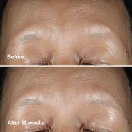 faces سيروم كلينيك سمارت كلينيكال ريبير رينكل كوريكتنغ