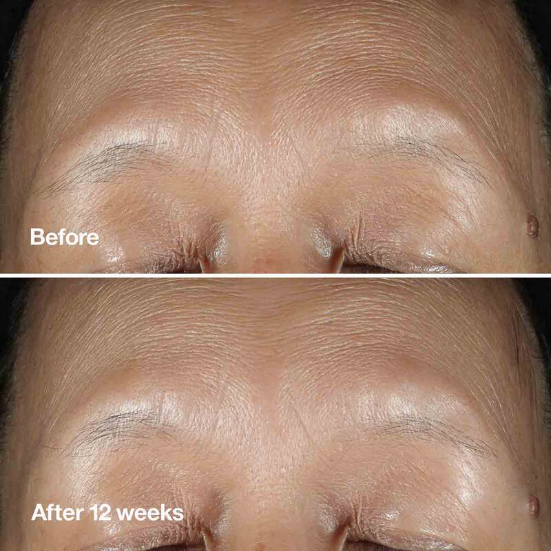 كلينيك سيروم كلينيك سمارت كلينيكال ريبير رينكل كوريكتنغ