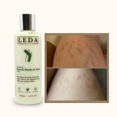 faces لوشن لعلامات التمدد 200مل