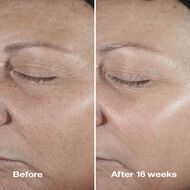 faces سيروم كلينيك سمارت كلينيكال ريبير رينكل كوريكتنغ