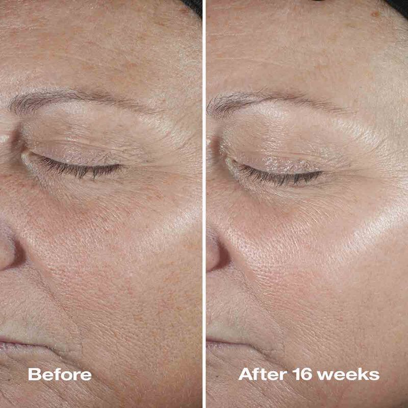 كلينيك سيروم كلينيك سمارت كلينيكال ريبير رينكل كوريكتنغ