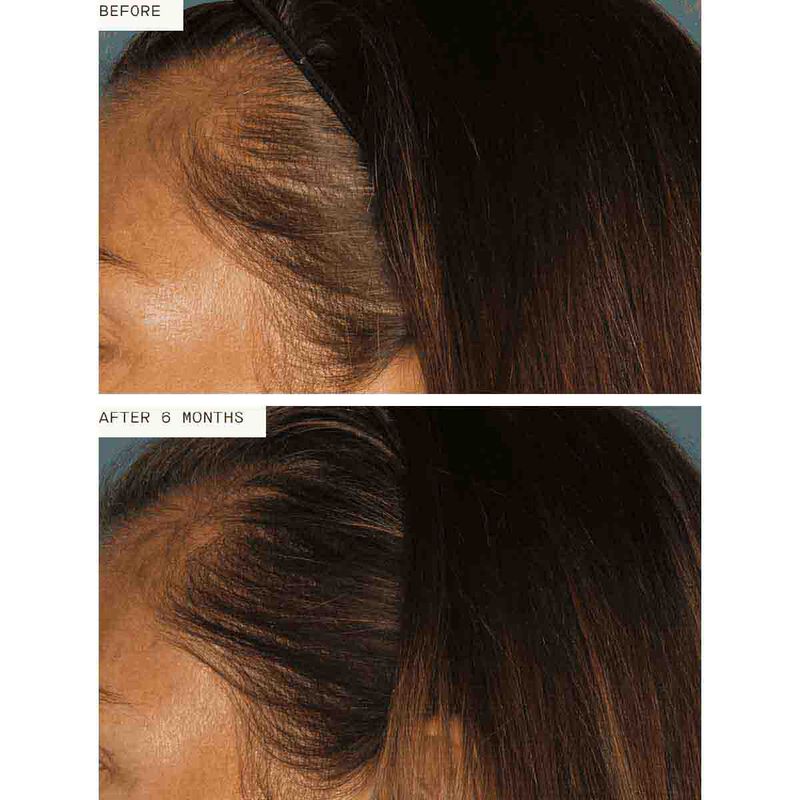 Women's Fullest Hair Growth Kit nutrafol women's fullest hair growth kit