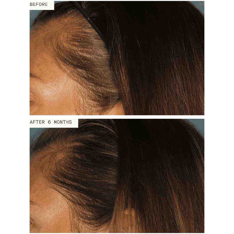 nutrafol hair growth pack