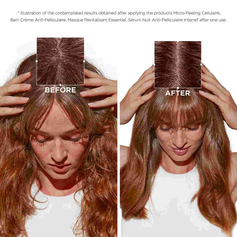 كيراستاس سيمبيوز بلسم ملطف للشعر المعرّض للقشرة 200 مل