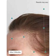 faces balance hair growth nutraceutical 120 capsules