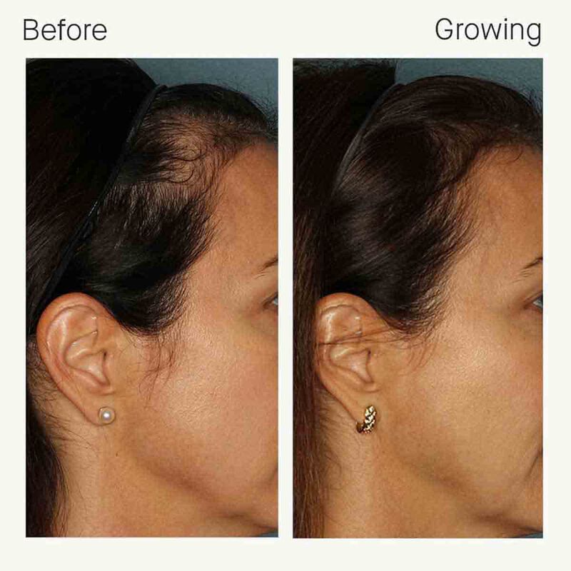 nutrafol women's fullest hair growth kit