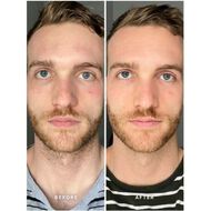 faces vitamin b serum with 5 niacinamide
