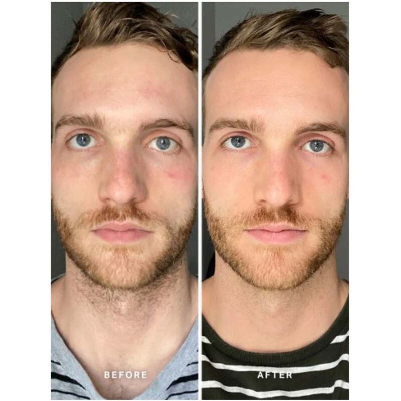 alpha h vitamin b serum with 5 niacinamide
