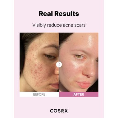 faces cosrx the niacinamide 15 serum 20ml