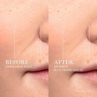 faces renergie h c f triple serum high performance anti aging concentrate 50ml
