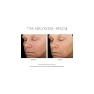 faces tns advanced serum