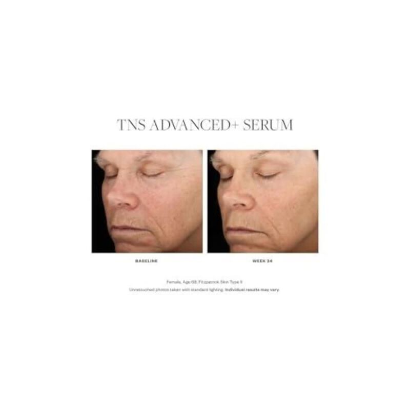 skinmedica tns advanced serum