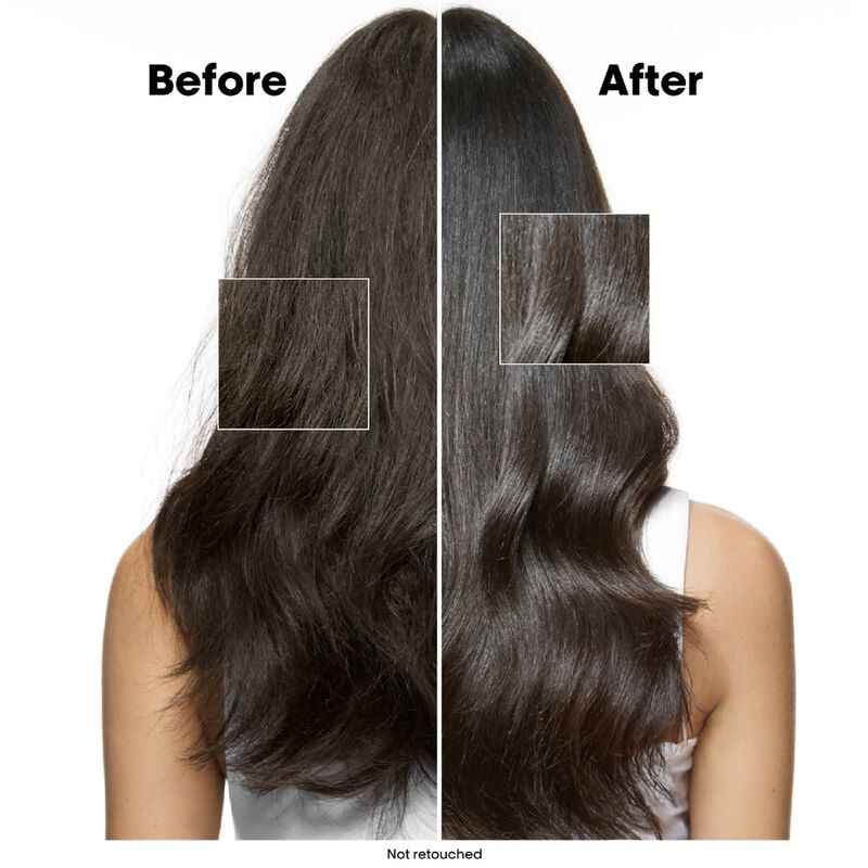 لوريال بروفيشنال شامبو سكالب أدفانسد ضدّ القشرة والمنقّي لفروة الرأس