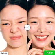 سيروم مهدئ بالألوفيرا وPDRN faces سيروم مهدئ بالألوفيرا وpdrn