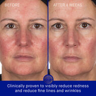 The Hydrogel Face Mask faces the hydrogel face mask