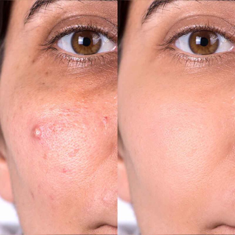 سينس ايت ايت مرطب غني بمضادات الأكسده