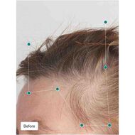 faces balance hair growth pack