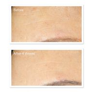 faces كريم الريتينول لتجديد شباب البشرة