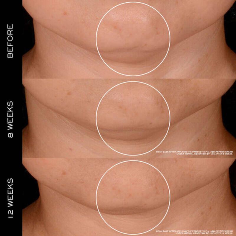 lancome renergie 300peptide