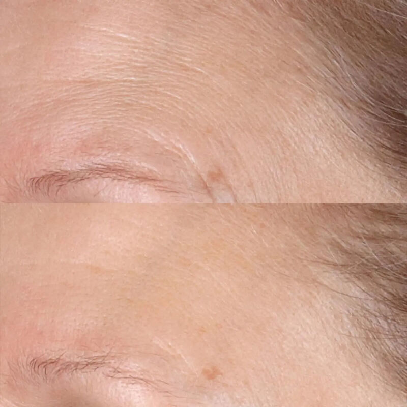 Vitamin C Ester Daily Brightening and Exfoliating Peel perricone md vitamin c ester daily brightening and exfoliating peel