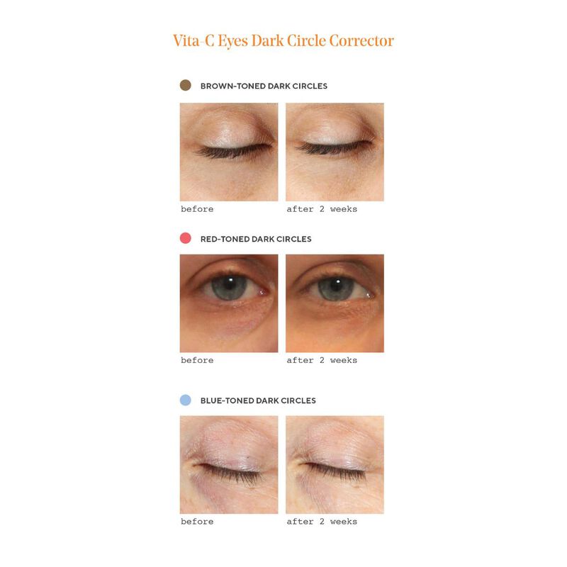 murad vitac dark circle corrector