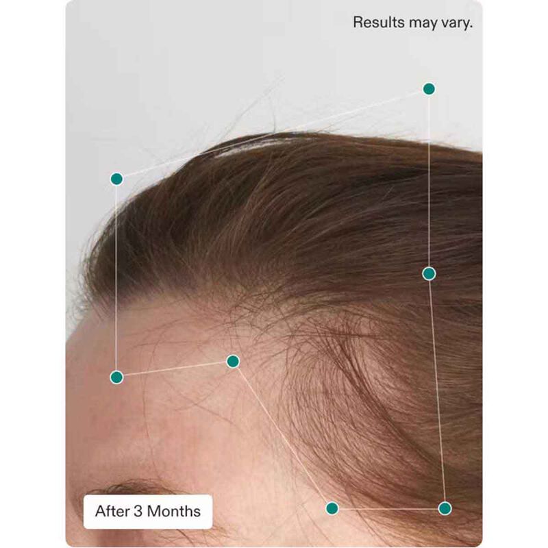 nutrafol balance hair growth pack