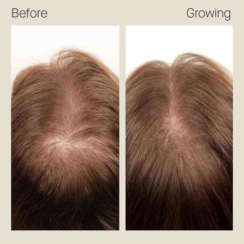 nutrafol hair growth pack
