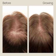 faces women s fullest hair growth kit