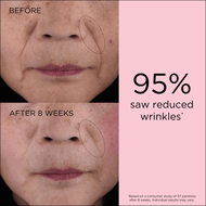 RETINOL + HPR Ceramide Capsules Rapid Skin Renewing Serum faces retinol hpr ceramide capsules rapid skin renewing serum