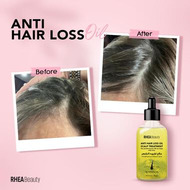 faces anti hair loss oil   rosemary oil
