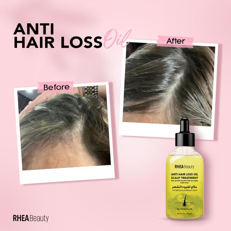rhea beauty anti hair loss oil ( rosemary oil)