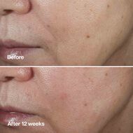 faces سيروم كلينيك سمارت كلينيكال ريبير رينكل كوريكتنغ