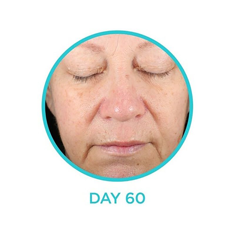 Bio Gel Firm Moisturizing Hydrogel neocutis bio gel firm moisturizing hydrogel