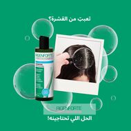 faces anti dandruff shampoo