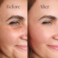 Hyaluronic Acid Serum faces hyaluronic acid serum